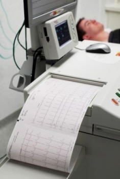 elektrocardiogram ecg