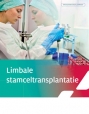 Cover brochure limbale stamceltransplantatie